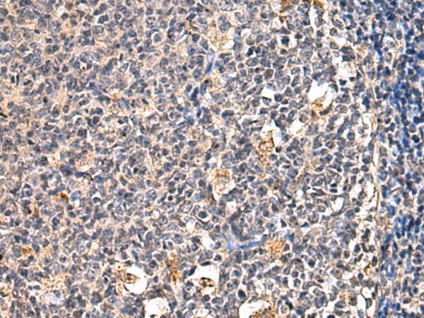 CD39 Antibody