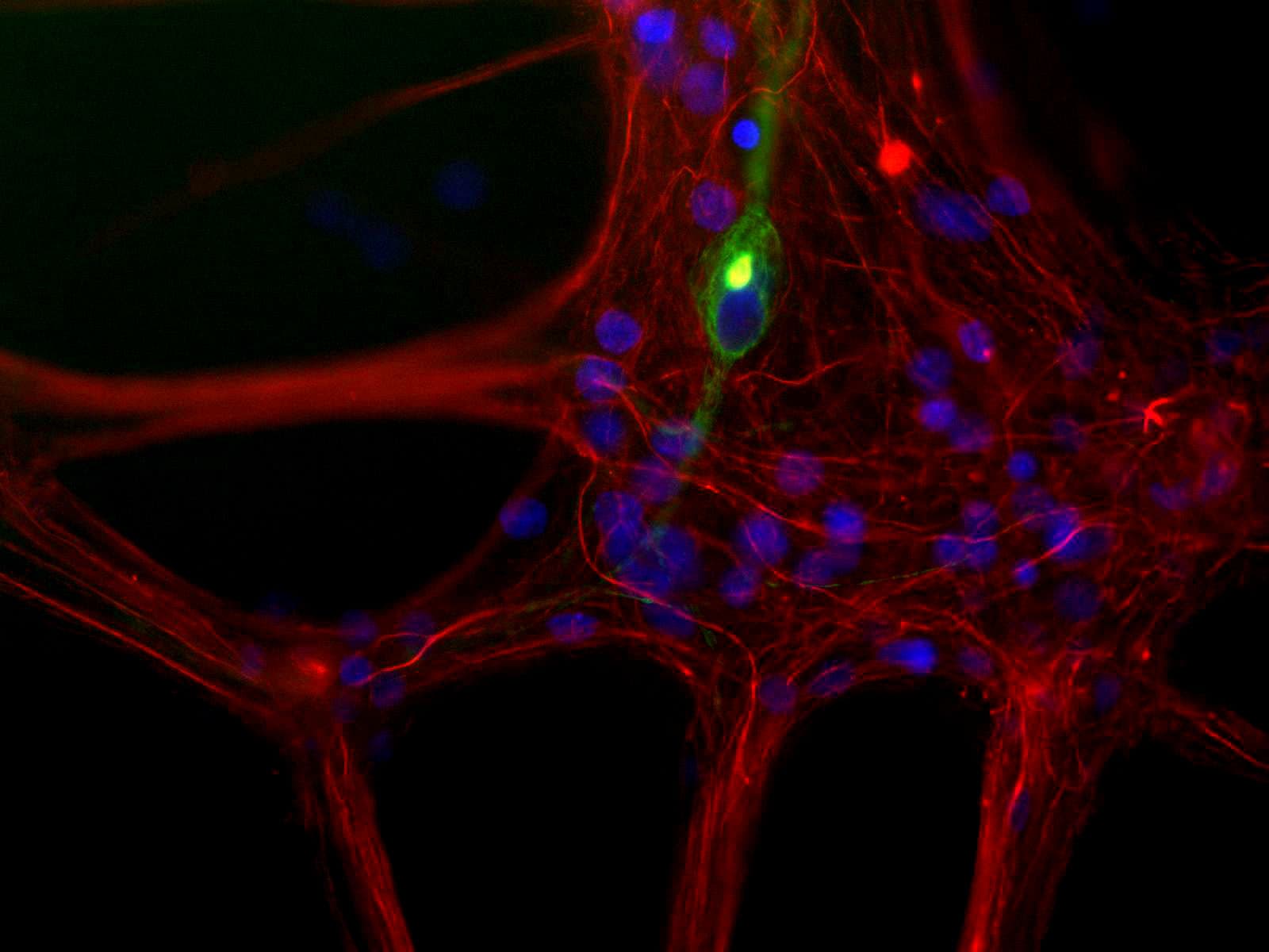 Monoclonal Mouse anti-Human Peripherin Antibody (clone 7C5, WB)