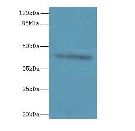 RPUSD4 Antibody