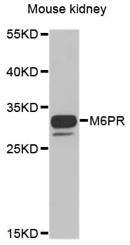IHC-plus™ M6PR Antibody