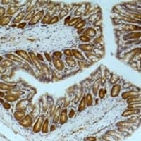 PRKAA1 / AMPK Alpha 1 Antibody