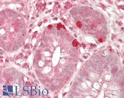 IHC-plus™ LRPAP1 Antibody