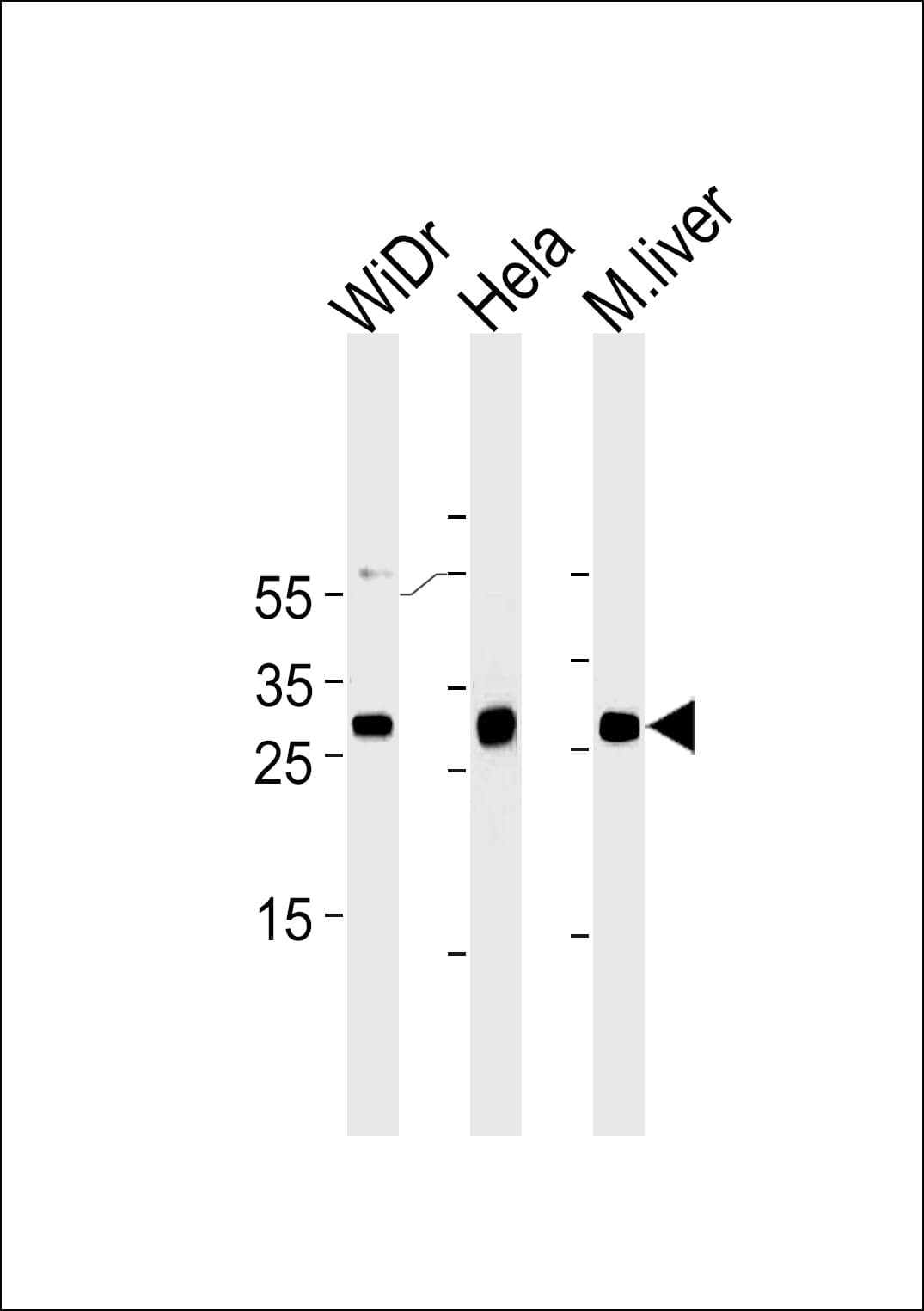 CDX1 Antibody (clone 937CT11.6.2)