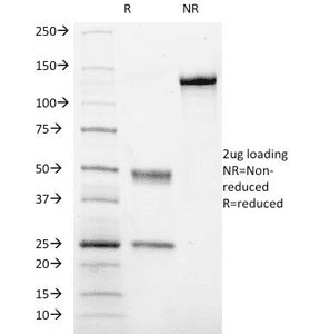 ITGA2B / CD41 Antibody (clone ITGA2B/1036)