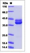 Human SCGB2A1 / Mammaglobin B Protein (Recombinant Human IgG Fc, C-terminus)