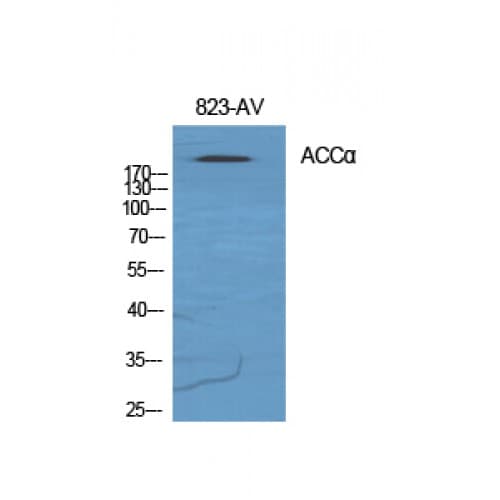 Acetyl-CoA Carboxylase / ACC Antibody (20-100 aa)