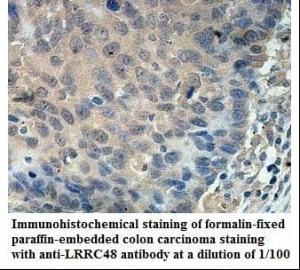 LRRC48/DRC3 Antibody (aa245-416)