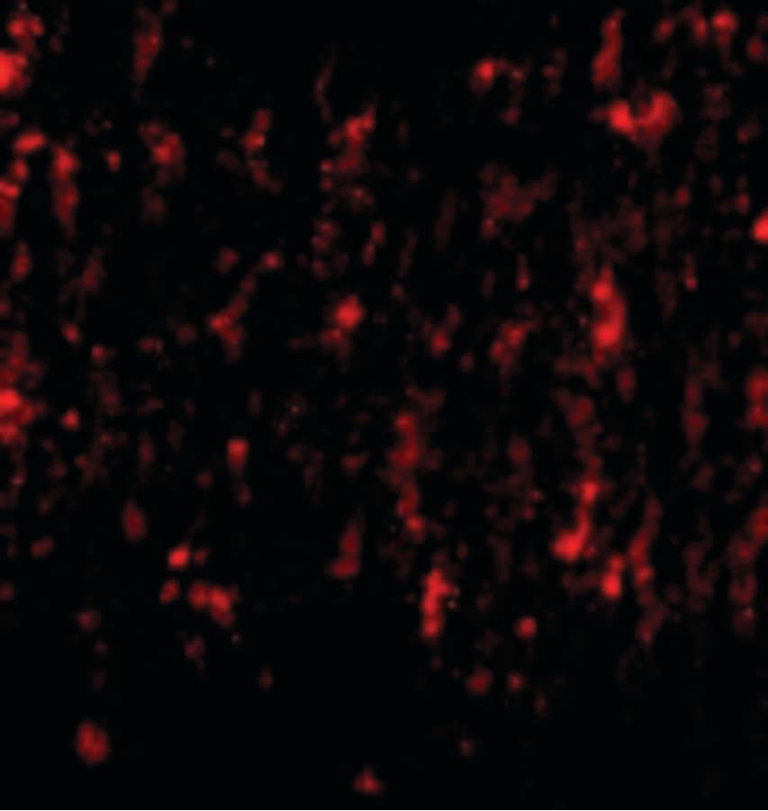 SATB2 Antibody