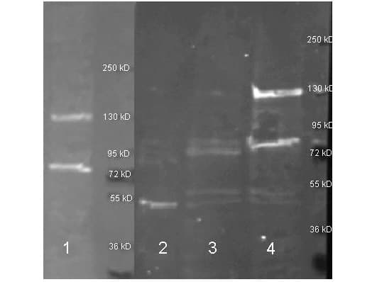 ADA / Adenosine Deaminase Antibody