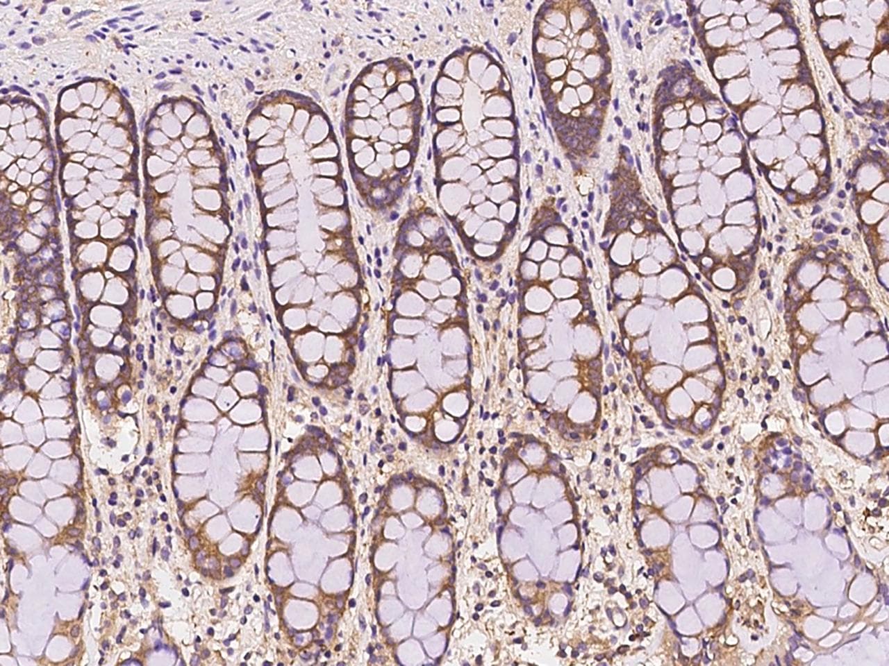 NARS Antibody