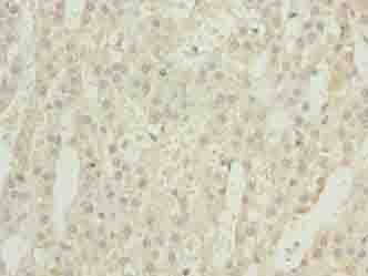 Polyclonal Rabbit anti-Human GEMIN6 / Gemin-6 Antibody (IHC)