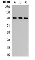 Polyclonal Rabbit anti-Human ZP1 Antibody (Internal, IHC, WB)