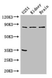 Polyclonal Rabbit anti-Human RPS6KA4 / MSK2 / RSK-B Antibody (IF, WB)