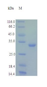 Human TIGAR Protein (Recombinant Tat)