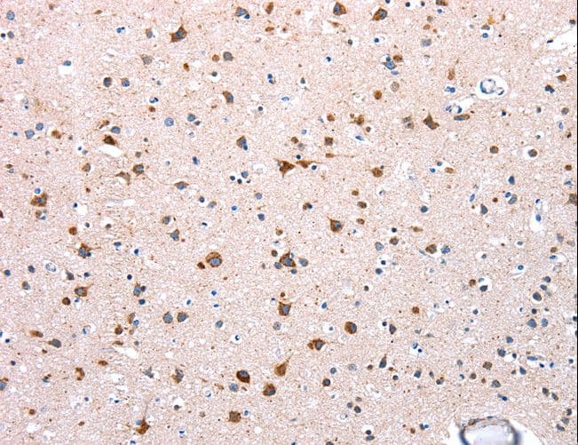 NDUFA12 / B17.2 Antibody