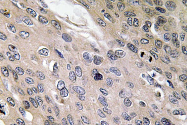 BMP6 Antibody (aa103-152)