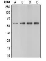 CASP10 / Caspase 10 Antibody (C-Terminus)