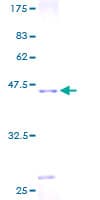 Human DIO3 Protein (Recombinant GST)