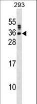 Polyclonal Rabbit anti-Human SSX5 Antibody (aa1-30, WB)
