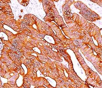Cytokeratin AE1+AE3 Antibody (clone AE1+AE3, Azide-free, BSA-free)
