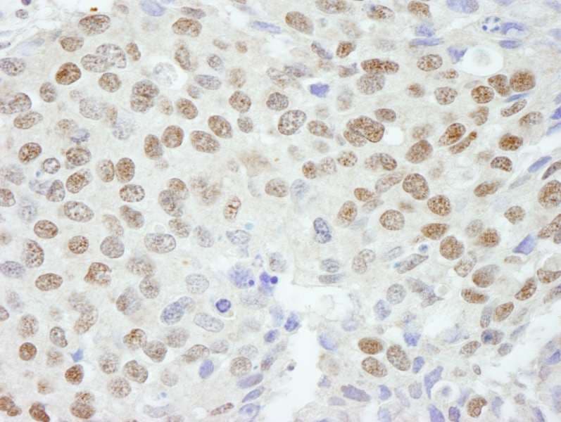ZNF295 Antibody (aa875-925)