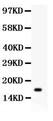 IL16 Antibody (aa1212-1332)