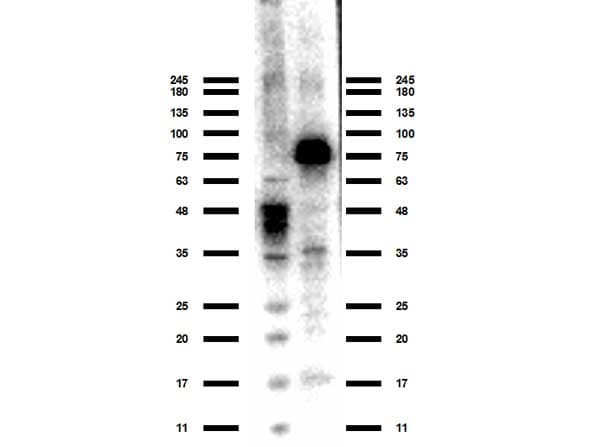 Polyclonal Rabbit anti-Human ACSS2 / ACAS2 Antibody (N-Terminus, WB)