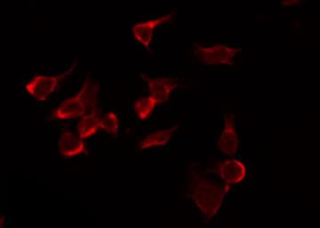 NARG1 / NAA15 Antibody