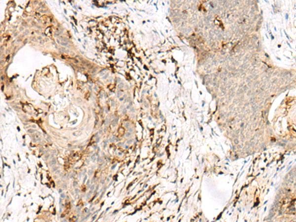 Polyclonal Rabbit anti-Human OVOL2 Antibody (IHC, WB)