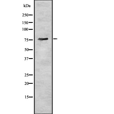 BDKRB2/Bradykinin B2 Receptor Antibody