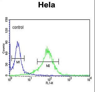 Polyclonal Rabbit anti-Human Lumican Antibody (aa64-91, IHC, WB)