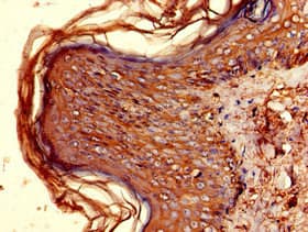 HLA-DQB1 Antibody