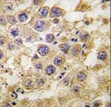 Polyclonal Rabbit anti-Human NANOS2 / NOS2 Antibody (aa108-137, IHC, WB)