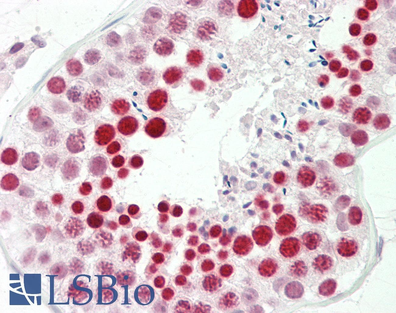 RBMXL2 Antibody (aa215-264)