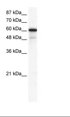 GABRA1 Antibody (N-Terminus)