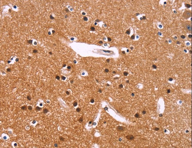 Polyclonal Rabbit anti-Human SIMPL / IRAK1BP1 Antibody (IHC, WB)