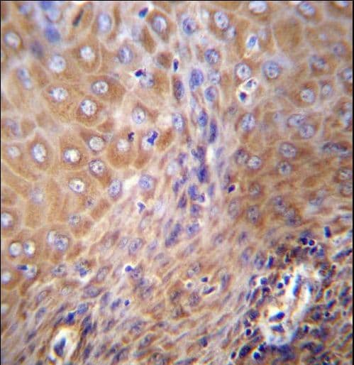 Polyclonal Rabbit anti-Human SLC6A14 Antibody (aa602-631, IHC, WB)