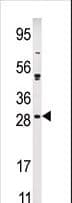Polyclonal Rabbit anti-Human CIB2 / KIP2 Antibody (aa8-37, IHC, WB)
