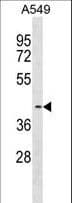 FADS3 Antibody (aa328-355)