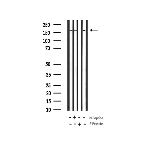 IRS1 Antibody (phospho-Ser639)