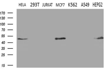 Monoclonal Mouse anti-Human GNAS Antibody (clone OTI7A4, IHC, WB)