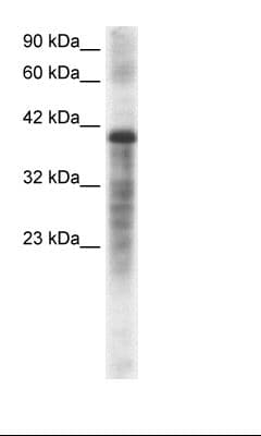 Polyclonal Rabbit anti-Human PSMC3 Antibody (aa293-339, IHC, WB)
