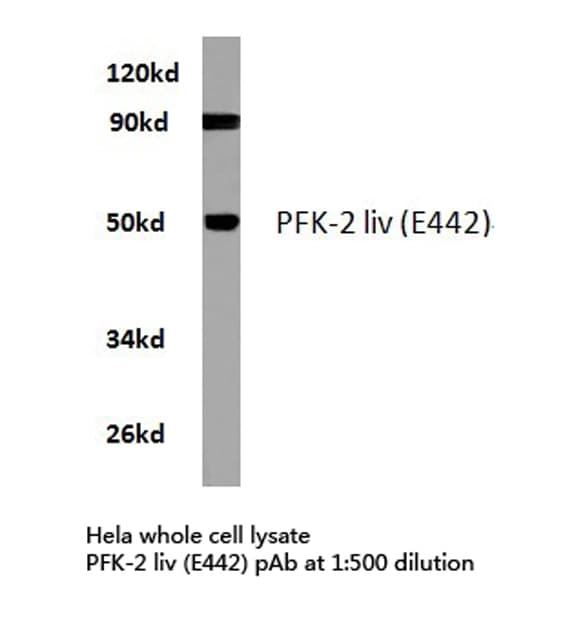 Polyclonal Rabbit anti-Human PFKFB1 Antibody (Glu442, IHC, WB)