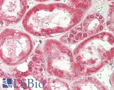 IHC-plus™ KAT2A / GCN5 Antibody (aa691-740)