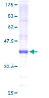 Human BARX1 Protein (Recombinant GST)