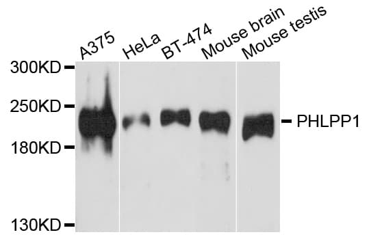Polyclonal Rabbit anti-Human SCOP / PHLPP Antibody (WB)