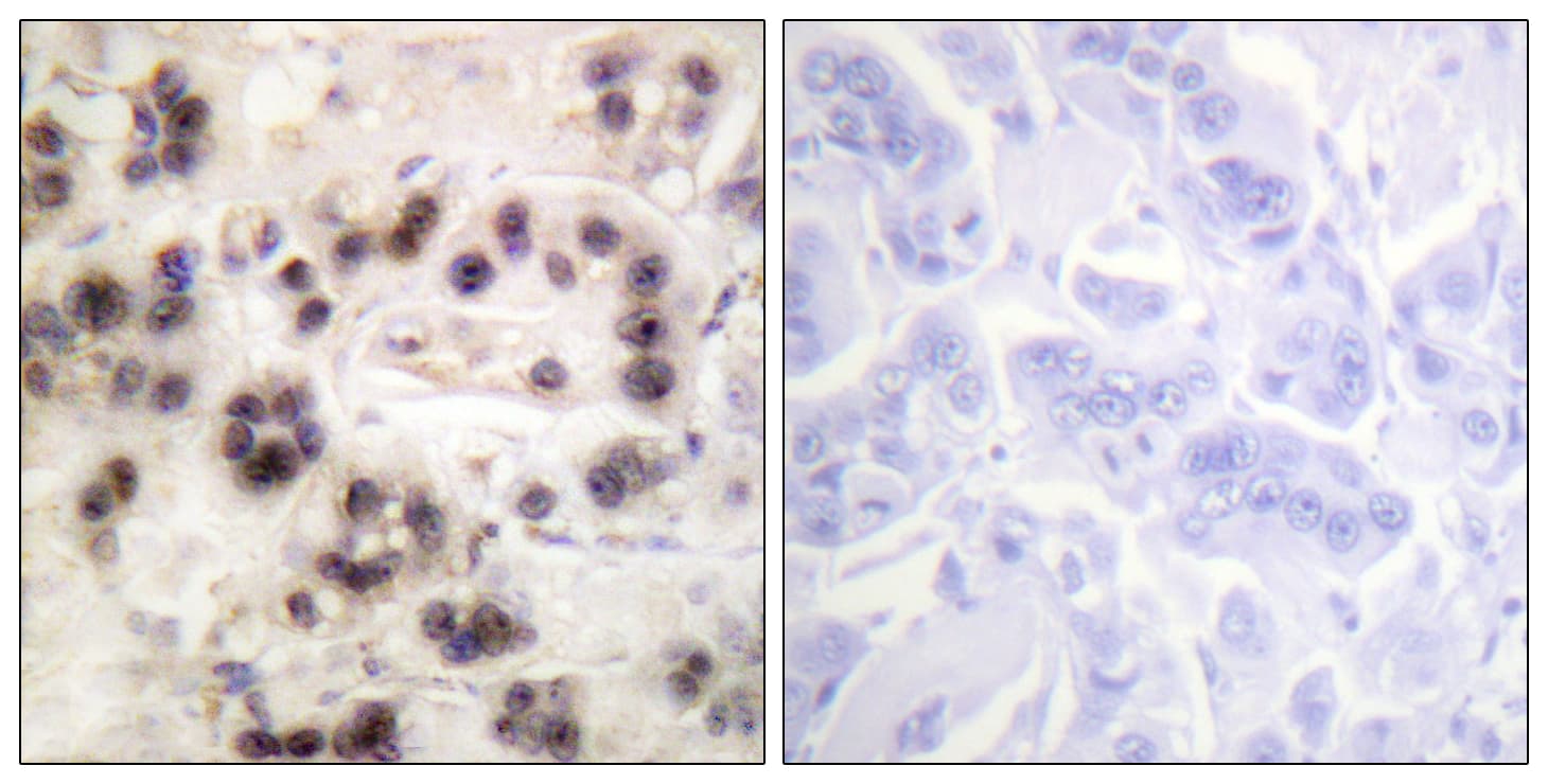 TP63 / p63 Antibody (phospho-Ser455)