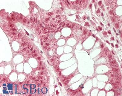 IHC-plus™ Polyclonal Rabbit anti-Human SLCO4A1 / OATP1 Antibody (aa672-722, IHC, WB)