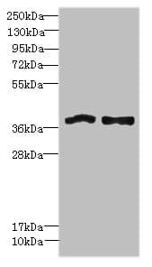Polyclonal Rabbit anti-Human FPR1 / FPR Antibody (IHC, WB)