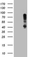 SERPINB1 Antibody (clone OTI3B4)